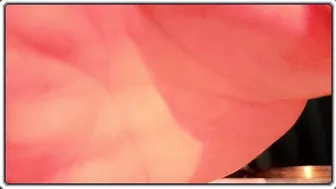 zesty_peach cam nude 08/22/2026