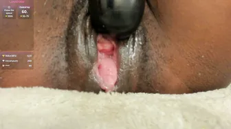 ebonyprolapse recorded nude video 127869