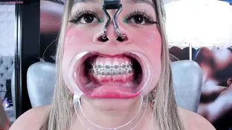 miss_evolet braces chat porn
