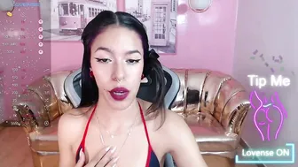 stephania_t braces 04-Dec-25
