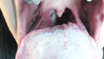 Katty_mouth saliva 12-14-2025