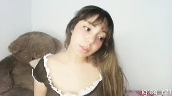 Emma_grayys braces 25-Jan-2026