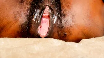 Ebonyprolapse 22 June 2025