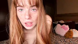 Cheekykatx redhead - 17-Feb-26