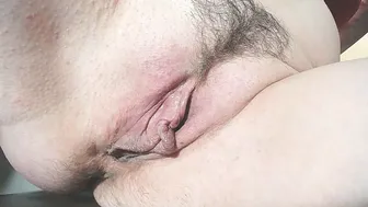 xollan hairy - 18-Feb-26