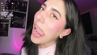 Bunnyy09 braces 03/03/2026