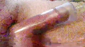 Camcplinaz 04/25/2026