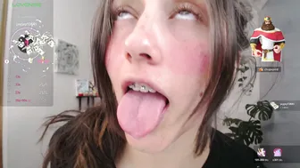 littlelaksmi braces - 29 May 2026